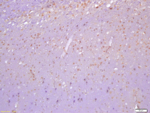 Phospho-Cofilin (Tyr140) Antibody in Immunohistochemistry (Paraffin) (IHC (P))