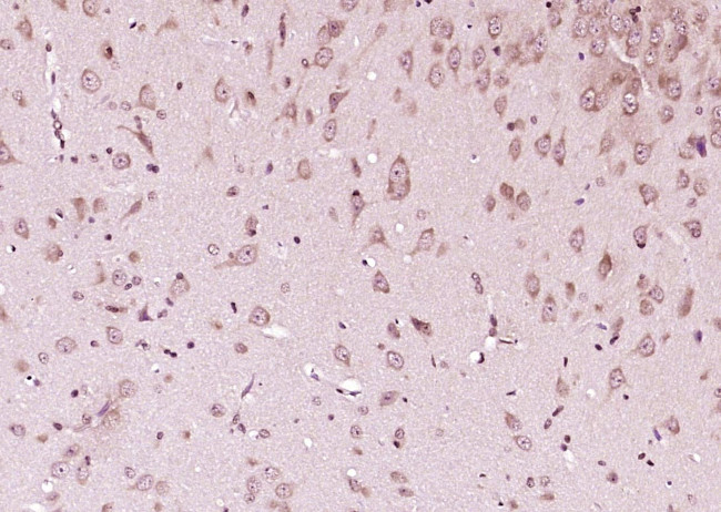 Phospho-CDKN1B (Thr198) Antibody in Immunohistochemistry (Paraffin) (IHC (P))