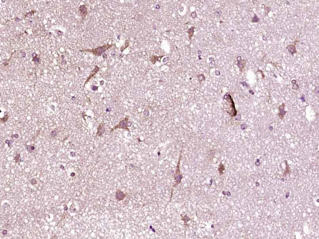 Phospho-CDK6 (Tyr24) Antibody in Immunohistochemistry (Paraffin) (IHC (P))