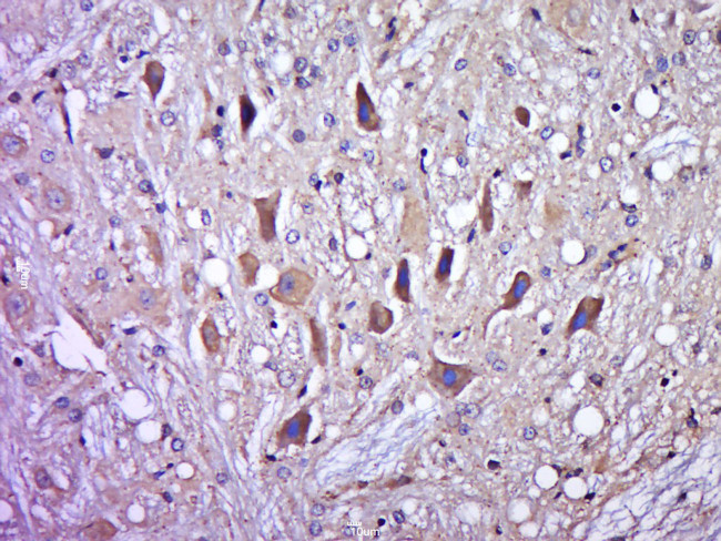 Phospho-DAXX (Ser213) Antibody in Immunohistochemistry (Paraffin) (IHC (P))