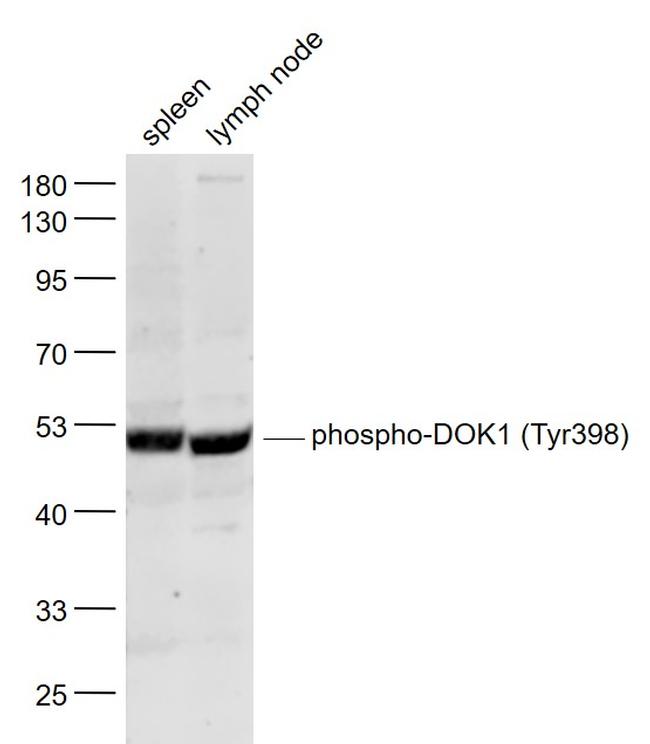 Phospho-DOK1 (Tyr398) Antibody in Western Blot (WB)