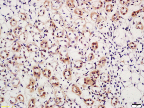 Phospho-DAXX (Ser517) Antibody in Immunohistochemistry (Paraffin) (IHC (P))