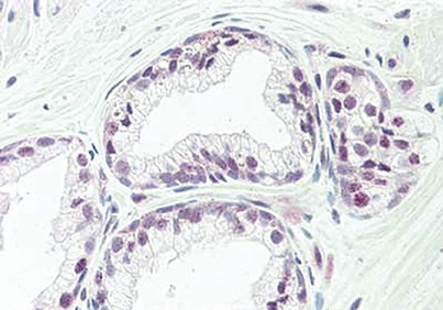 TAF1 Antibody in Immunohistochemistry (Paraffin) (IHC (P))