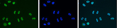 HDAC1 Antibody in Immunocytochemistry (ICC/IF)