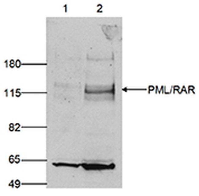 PML Antibody in Western Blot (WB)