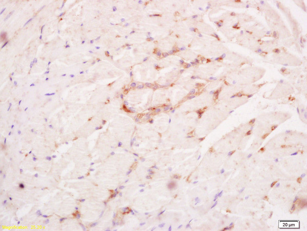 Phospho-FGFR1 (Tyr307) Antibody in Immunohistochemistry (Paraffin) (IHC (P))