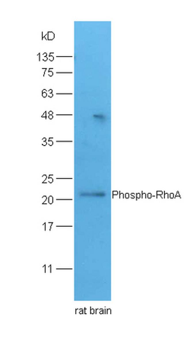 Phospho-RhoA (Ser188) Antibody in Western Blot (WB)