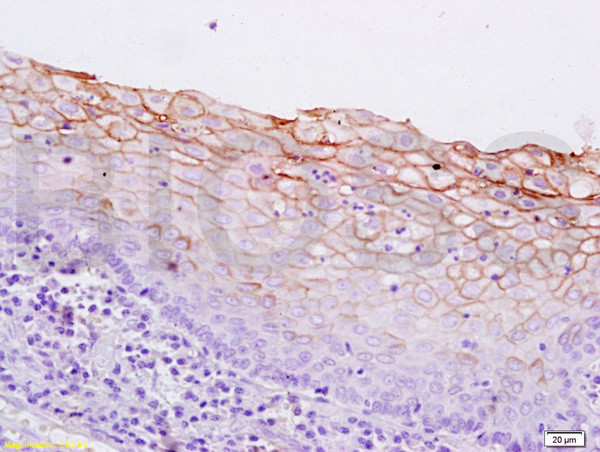 Cytokeratin 5 Antibody in Immunohistochemistry (Paraffin) (IHC (P))