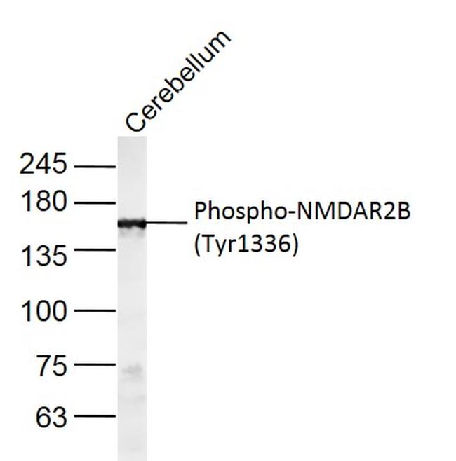 Phospho-NMDAR2B (Tyr1336) Antibody in Western Blot (WB)