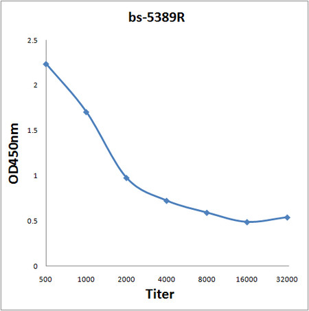Phospho-HDAC2 (Ser394) Antibody in ELISA (ELISA)