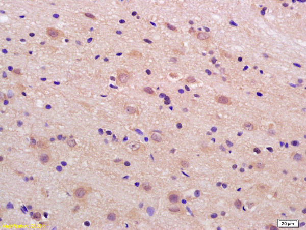 Phospho-LRP1 (Ser4523) Antibody in Immunohistochemistry (Paraffin) (IHC (P))