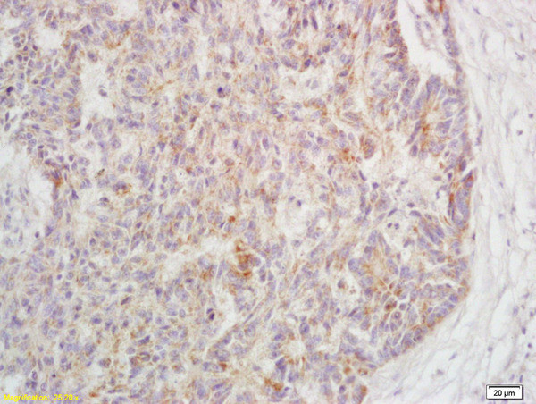 Phospho-TAK1 (Ser192) Antibody in Immunohistochemistry (Paraffin) (IHC (P))