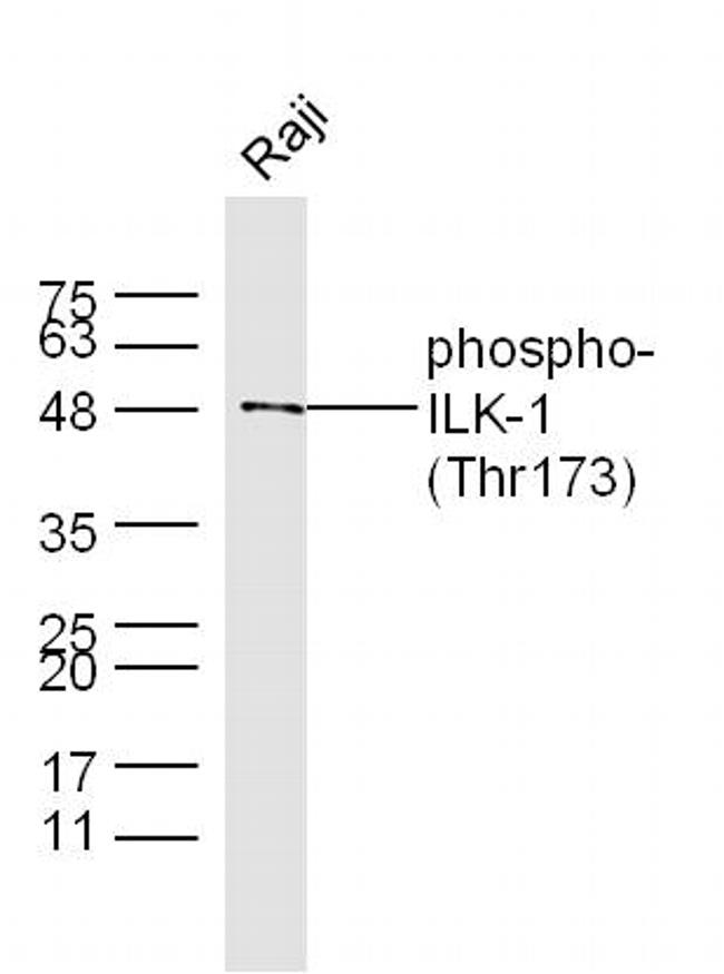 Phospho-ILK-1 (Thr173) Antibody in Western Blot (WB)