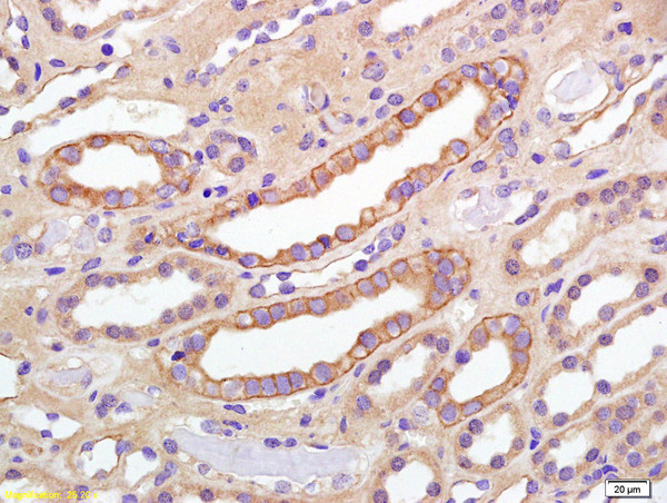 Phospho-IGF1R (Tyr980) Antibody in Immunohistochemistry (Paraffin) (IHC (P))