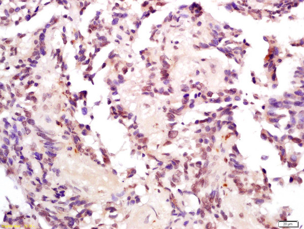 Phospho-MDM2 (Thr218) Antibody in Immunohistochemistry (Paraffin) (IHC (P))