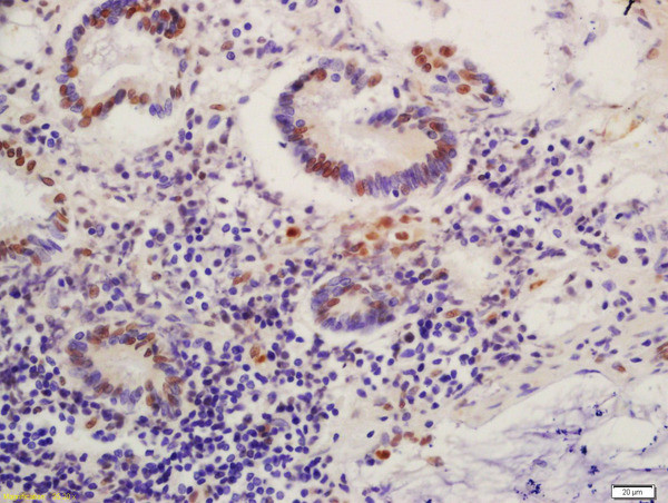 Phospho-MDM2 (Ser186) Antibody in Immunohistochemistry (Paraffin) (IHC (P))
