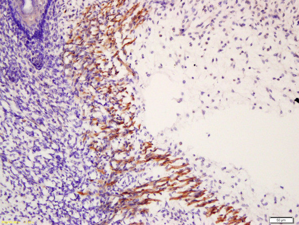 Phospho-MYL6 (Tyr29, Ser30) Antibody in Immunohistochemistry (Paraffin) (IHC (P))