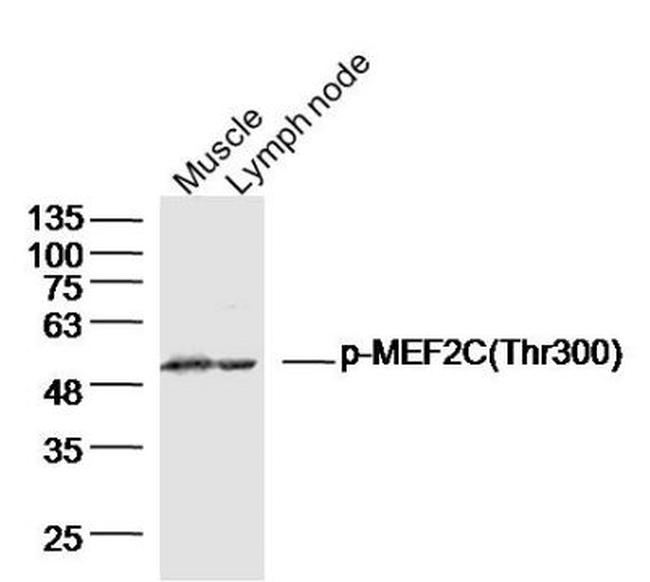 Phospho-MEF2C (Thr300) Antibody in Western Blot (WB)