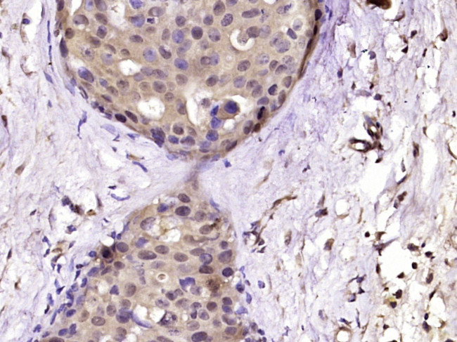 Phospho-ERK5 (Ser731, Thr733) Antibody in Immunohistochemistry (Paraffin) (IHC (P))