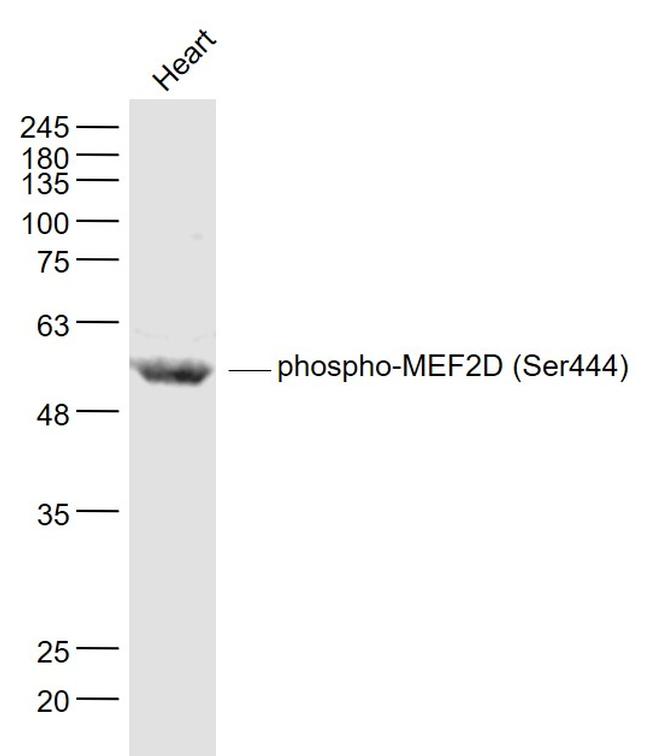 Phospho-MEF2D (Ser444) Antibody in Western Blot (WB)
