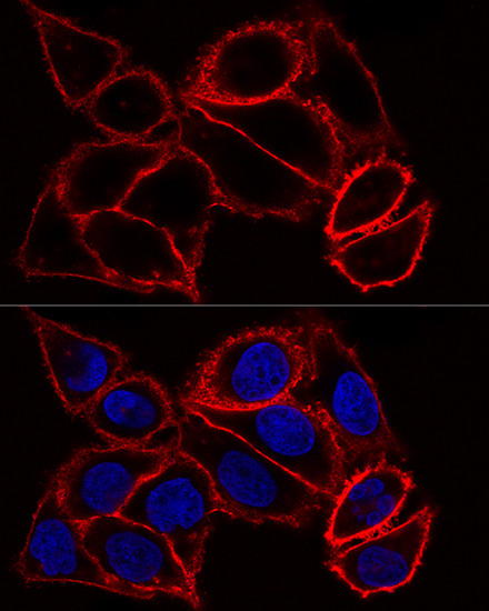 CD44 Antibody in Immunocytochemistry (ICC/IF)