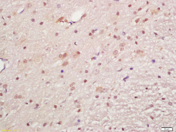 Phospho-MAPKAPK5 (Ser93) Antibody in Immunohistochemistry (Paraffin) (IHC (P))