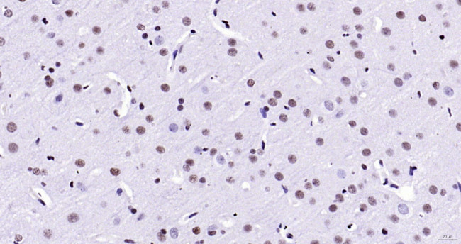 HMGB1 Antibody in Immunohistochemistry (Paraffin) (IHC (P))