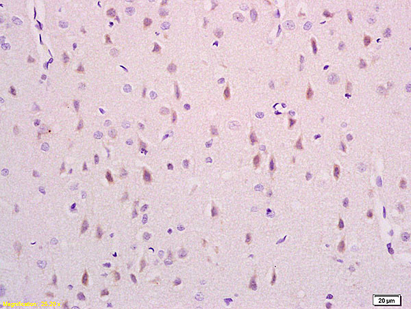 Phospho-NDEL1 (Ser231) Antibody in Immunohistochemistry (Paraffin) (IHC (P))