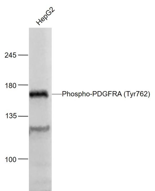 Phospho-PDGFRA (Tyr762) Antibody in Western Blot (WB)