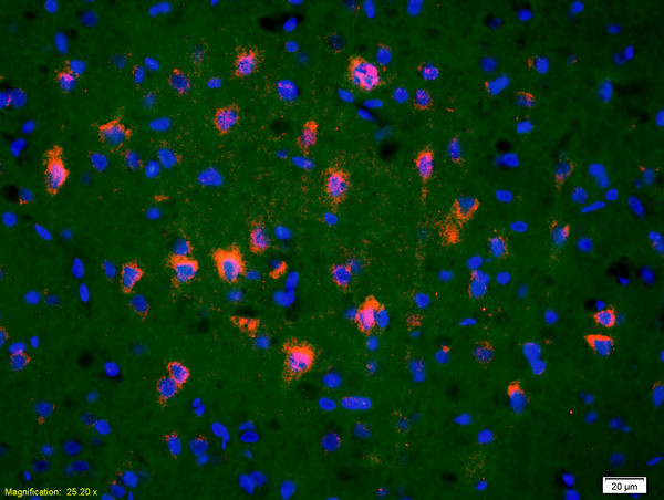 TRAK1 Antibody in Immunohistochemistry (Paraffin) (IHC (P))