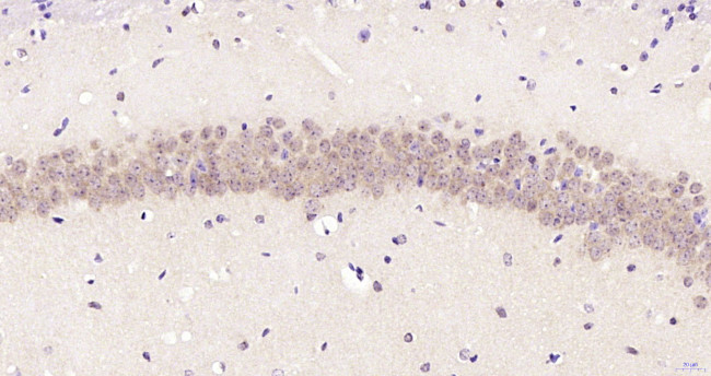Phospho-PKC delta (Ser645) Antibody in Immunohistochemistry (Paraffin) (IHC (P))