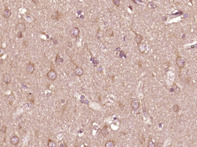 Phospho-PTPN6 (Tyr536) Antibody in Immunohistochemistry (Paraffin) (IHC (P))