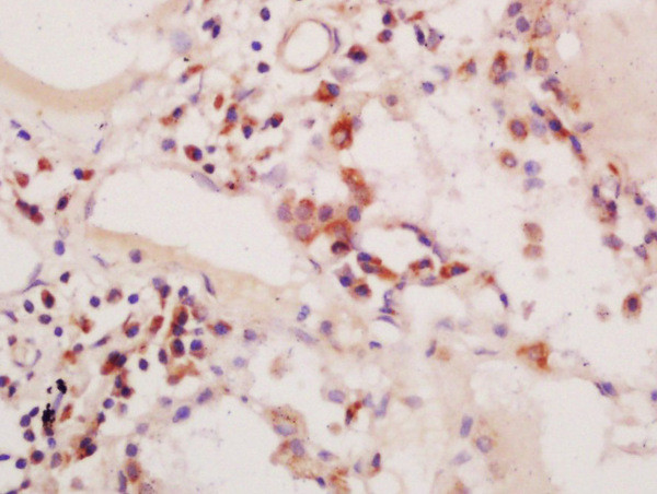 Phospho-PIK3C3 (Ser164) Antibody in Immunohistochemistry (Paraffin) (IHC (P))