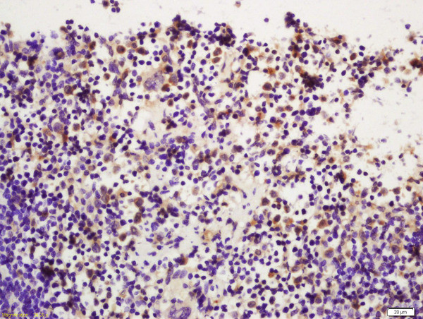 Phospho-PI 3 Kinase p110 delta (Tyr524) Antibody in Immunohistochemistry (Paraffin) (IHC (P))