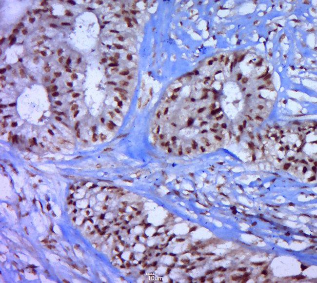 Phospho-P53 (Thr55) Antibody in Immunohistochemistry (Paraffin) (IHC (P))