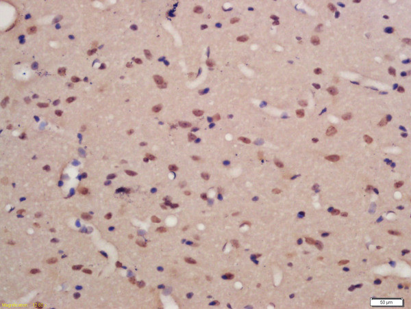 Phospho-TNIK (Ser769) Antibody in Immunohistochemistry (Paraffin) (IHC (P))