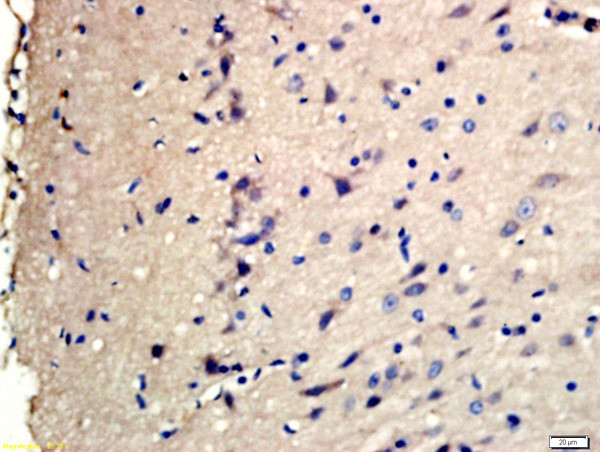 Phospho-TSC2 (Ser1798) Antibody in Immunohistochemistry (Paraffin) (IHC (P))