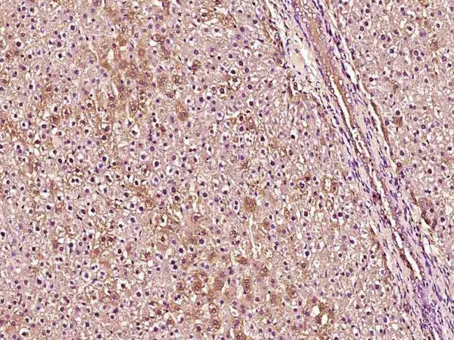 Phospho-TSC2 (Ser1418) Antibody in Immunohistochemistry (Paraffin) (IHC (P))