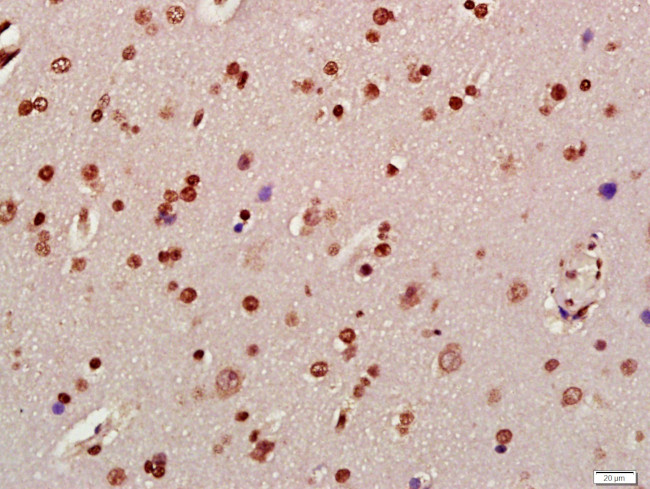 Phospho-Alpha synuclein (Tyr125) Antibody in Immunohistochemistry (Paraffin) (IHC (P))