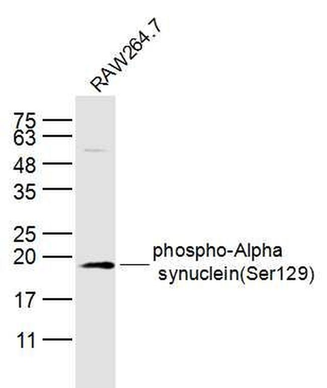 Phospho-Alpha synuclein (Ser129) Antibody in Western Blot (WB)
