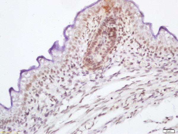 Phospho-c-Raf (Ser339) Antibody in Immunohistochemistry (Paraffin) (IHC (P))