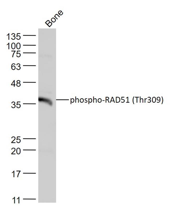 Phospho-RAD51 (Thr309) Antibody in Western Blot (WB)