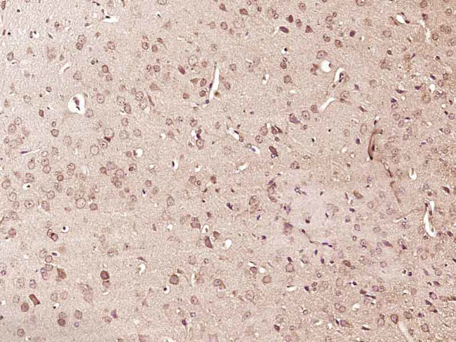 Phospho-RPS6KA1 (Thr348) Antibody in Immunohistochemistry (Paraffin) (IHC (P))