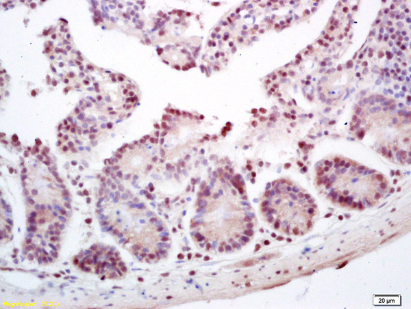 ZNF693 Antibody in Immunohistochemistry (Paraffin) (IHC (P))