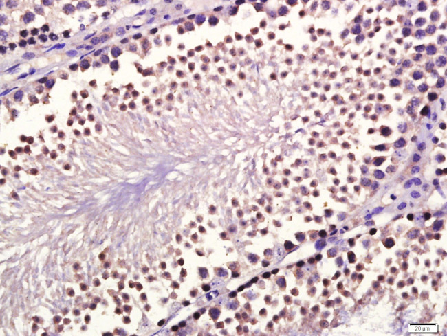 GDF10 Antibody in Immunohistochemistry (Paraffin) (IHC (P))