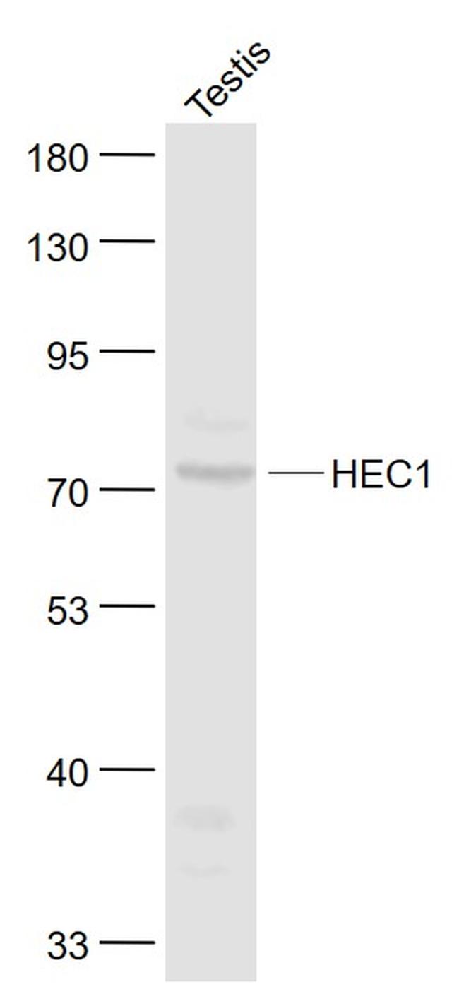 HEC1 Antibody in Western Blot (WB)