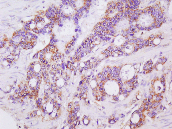 LGALS3BP Antibody in Immunohistochemistry (Paraffin) (IHC (P))