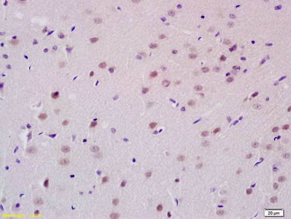PCGF1 Antibody in Immunohistochemistry (Paraffin) (IHC (P))
