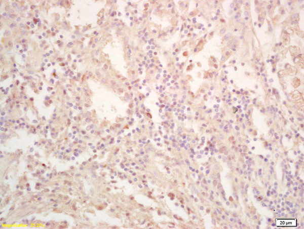 FES Antibody in Immunohistochemistry (Paraffin) (IHC (P))