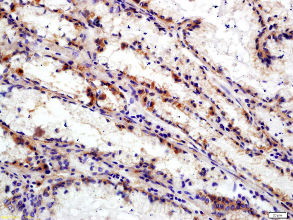 Integrin Alpha V + Beta 6 Antibody in Immunohistochemistry (Paraffin) (IHC (P))